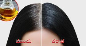 White Hair Remedies: ఆవ నూనెలో ఈ రెండు కలిపి వాడితే.. తెల్ల జుట్టు రమ్మన్నా రాదు