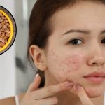 Chironji For Skin: చిరోంజిని ఇలా వాడితే.. ముఖంపై ఒక్క మచ్చ కూడా ఉండదు