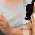 Skin Allergy: అలర్జీతో ఇబ్బంది పడుతున్నారా ? ఈ హోం రెమెడీస్ ట్రై చేయండి