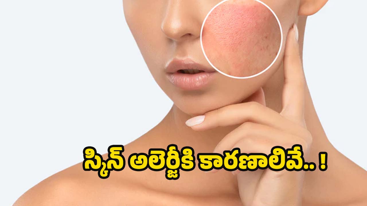 Skin Allergy: స్కిన్ అలెర్జీకి కారణాలేంటో తెలుసా ?