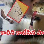 Snake Bite:10వ తరగతి పరీక్షా కేంద్రంలో అధికారిని కాటేసిన పాము