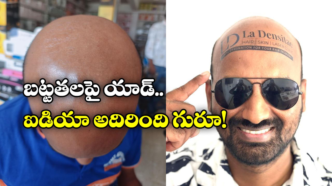 Viral News: బట్టతల ఉందని బాధపడుతున్నారా? అయితే, మీకు షఫీక్ గురించి తెలియాల్సిందే!