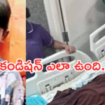 Sri Tej Health Update : శ్రీ తేజ్ లేటెస్ట్ హెల్త్ అప్డేట్… ఇంకా వెంటిలేటర్ పైనే..