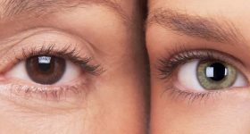 Color of Eyes: ఒక్కొక్కరికీ ఒక్కో కలర్ కళ్లు ఎందుకు ఉంటాయి? ఎదిగే కొద్ది కళ్ల రంగు మారుతుందా?