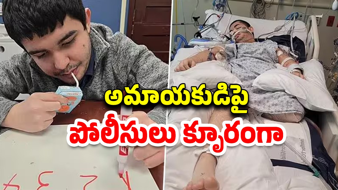 Police Shot Autistic Boy: మతి స్థితిమితం లేని యువకుడిపై కాల్పులు జరిపిన పోలీసులు.. 10 రోజులుగా కోమాలో..