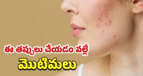 Pimples Skincare Tips: వేసవిలో మొటిమల సమస్య.. క్లీన్ చర్మం కోసం ఈ చిట్కాలు పాటించండి