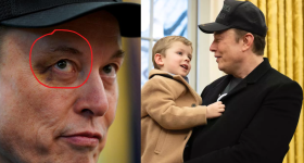 Elon Musk: కొడుకుతో తన్నులు తిన్న మస్క్ మామ.. పాపం కన్ను చూశారా ఎలా అయిపోయిందో!
