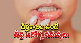 Mouth Ulcers Causes: నోటి పూతలు ఎందుకు వస్తాయి?.. నివారణకు ఈ జాగ్రత్తలు పాటించండి