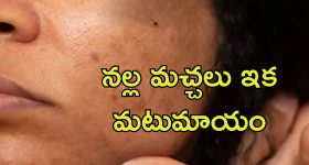 Dark Spots On Face: నల్ల మచ్చలు లేని మెరిసే చర్మం కావాలా.. ఈ జ్యూస్‌తో ఖర్చు లేకుండా