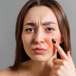 Tips For Sensitive Skin: సెన్సిటివ్ స్కిన్‌తో ఇబ్బంది పడుతున్నారా ? ఈ టిప్స్ పాటిస్తే బెస్ట్ రిజల్ట్