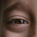 Itchy Eyes: కళ్ళు దురద పెడుతున్నాయా? కనురెప్పల్లో పురుగులు ఉన్నాయేమో చూసుకోండి