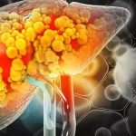 Liver Health: మీరు చేసే ఈ పొరపాట్లే.. లివర్ డ్యామేజ్‌కి కారణం !