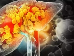 Liver Health: మీరు చేసే ఈ పొరపాట్లే.. లివర్ డ్యామేజ్‌కి కారణం !