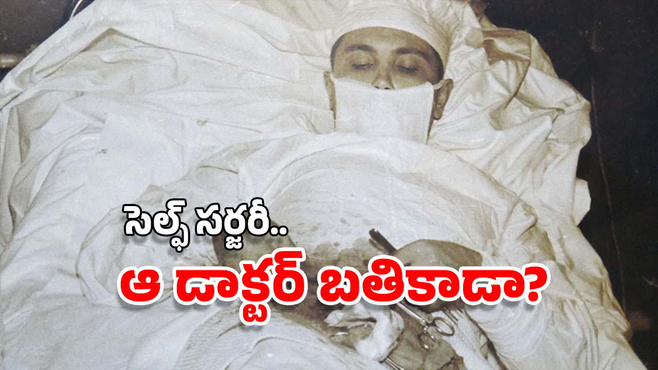Self Surgery: మత్తు లేకుండా.. కడుపు కోసుకుని.. తనకి తానే సర్జరీ చేసుకున్న ఈ డాక్టర్ గురించి తెలుసా?